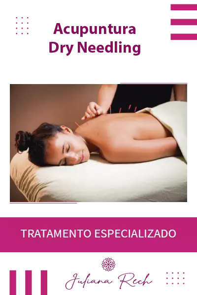 acupuntura drey needling