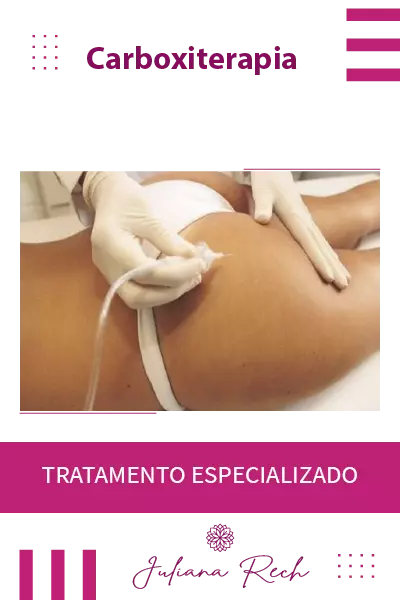 carboxiterapia